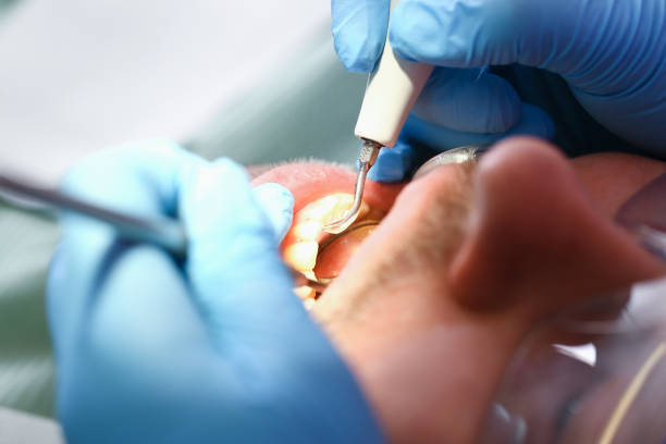 Emergency Dentist for Kids in GA